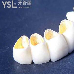北京做了牙冠多少錢(qián)？