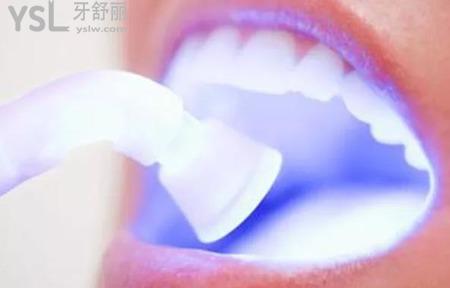 牙齒美白要多少錢？