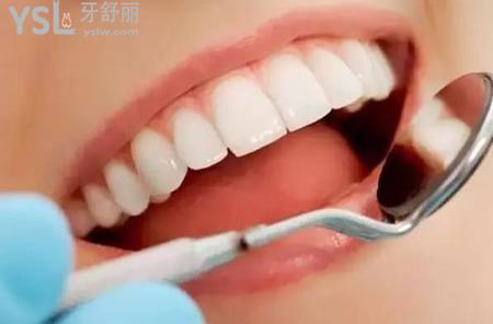 冷光美白牙齒需要注意什么？