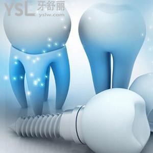 種植牙體哪個國家的質(zhì)量好，國產(chǎn)、瑞士、韓國選哪個？