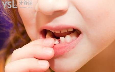 為什么牙齒松動？