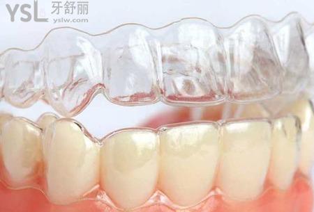 小孩牙齒矯正可以使用隱形矯治器嗎？