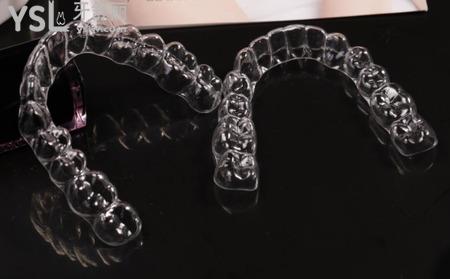 30歲還可以矯正牙齒么？
