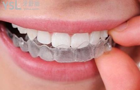 矯正牙齒需要多少錢？