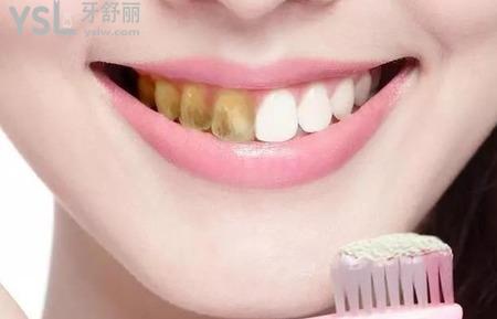 牙齒發(fā)黃怎么變白？