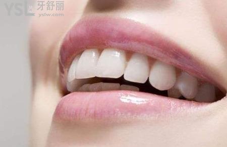 為什么看牙要趁早？