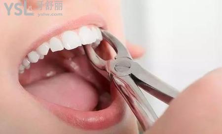 拔完智齒臉會(huì)不會(huì)??？