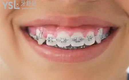 保持器多久換一次？
