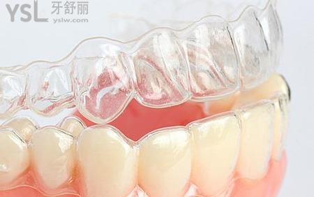 門牙歪了一顆能掰正嗎？