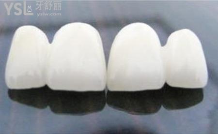 烤瓷牙有什么后遺癥？