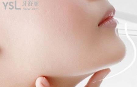 為什么要進(jìn)行下巴整形？