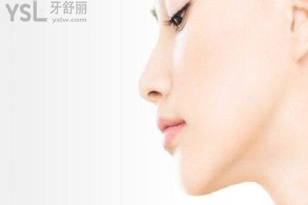 微整形下巴填充的成效怎么樣？