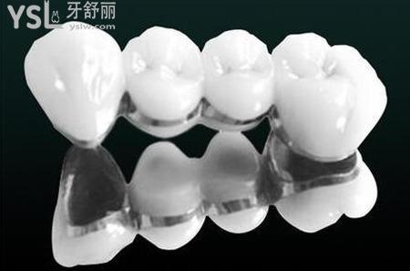 帶烤瓷牙能不能用電動(dòng)牙刷？