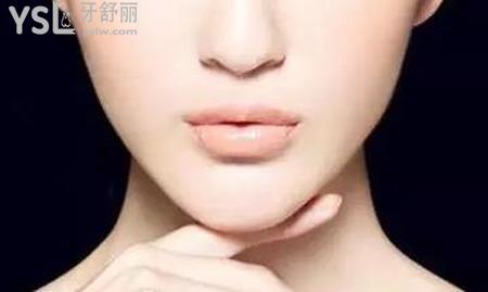 假體隆下巴優(yōu)點是什么？