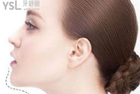 下巴整形術(shù)后怎么護理？