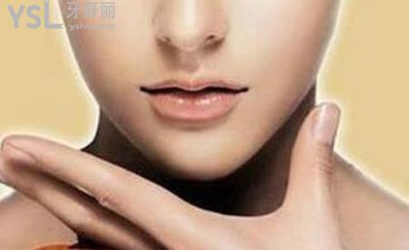 下巴長整形要多少錢？