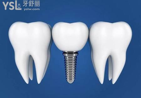 種植牙的治療過(guò)程是怎樣的？