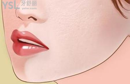 正頜手術(shù)費用是多少？