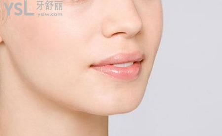 正頜手術(shù)后遺癥嚴(yán)重嗎？