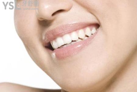 正頜手術(shù)適合哪些人做？
