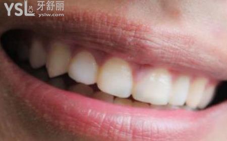 牙發(fā)軟是什么原因？