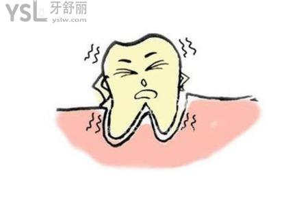 牙齒3度松動還能保嗎？