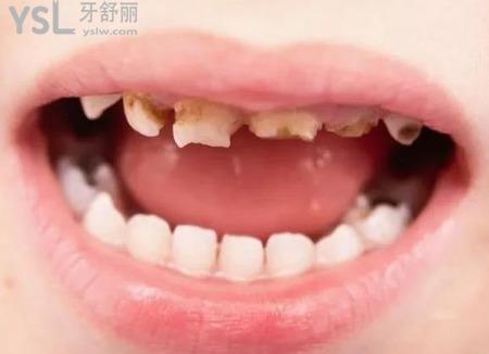 正畸后的牙齒老了容易松動脫落嗎？