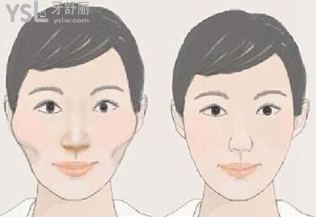 顴骨疼怎么辦？