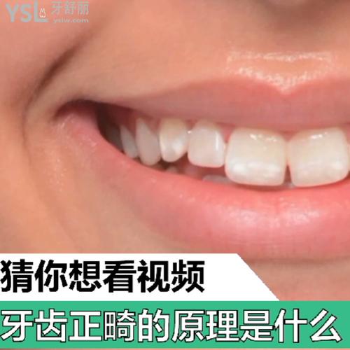 牙齒正畸的原理是什么？