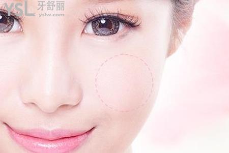磨骨手術(shù)會留下疤痕嗎？