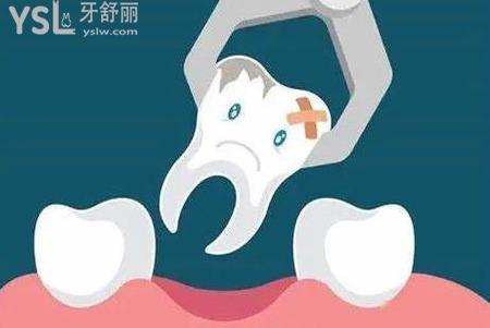 拔牙以后注意什么事項(xiàng)？