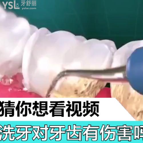 洗牙對牙齒有傷害嗎？