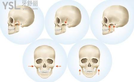 怎么看自己顴骨高不高？