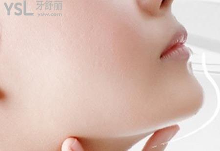 下巴歪怎么回事？