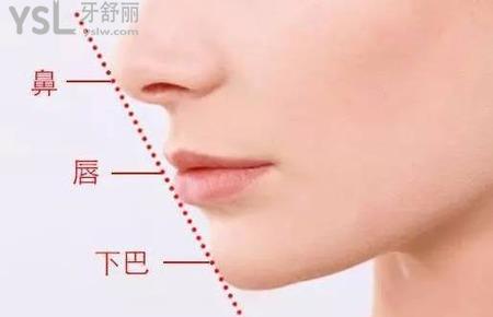 下巴突出怎么辦？