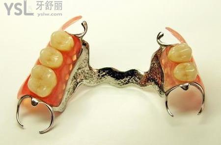 活動假牙和固定假牙哪個比較好？