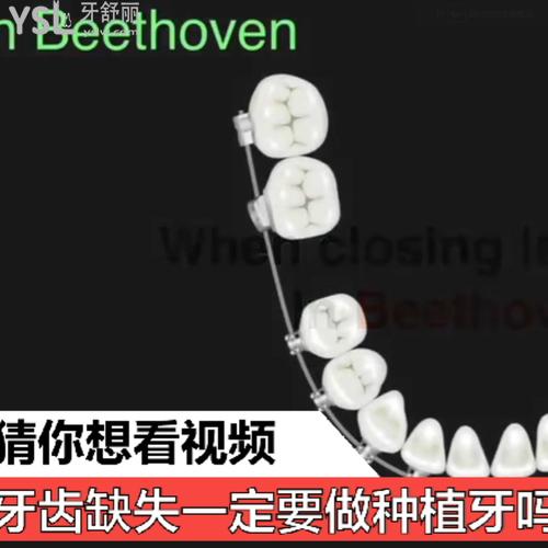 牙齒缺失一定要做種植牙嗎，聽說矯正也可以解決？