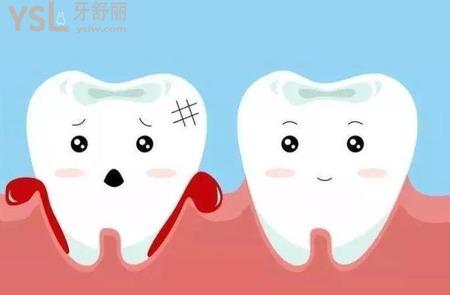 牙周炎引起的臉腫怎么辦？