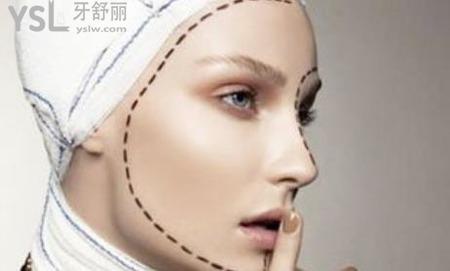 顴骨一高一低怎樣改善？