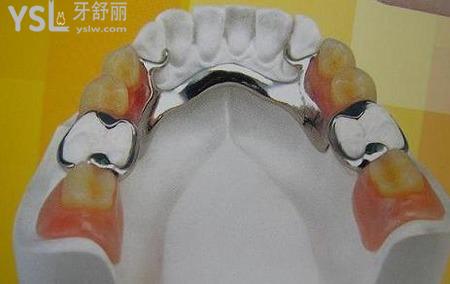帶假牙疼怎么辦？