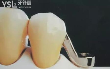夜晚睡覺磨牙怎么回事？