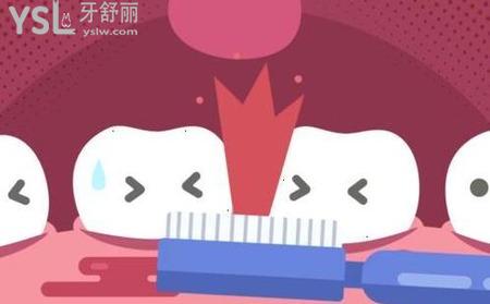 如何判斷自己有牙周炎？