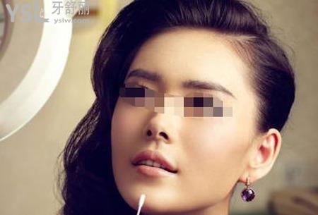 下頜角肥大如何矯正？