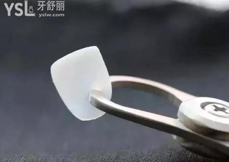 牙貼面能維持多久？