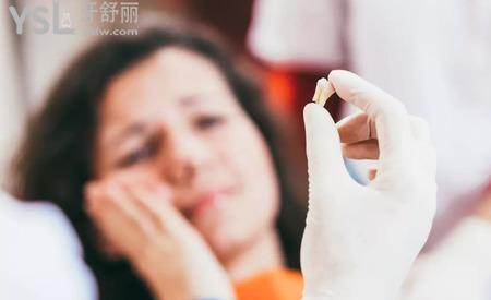 智齒拔了要痛幾天？
