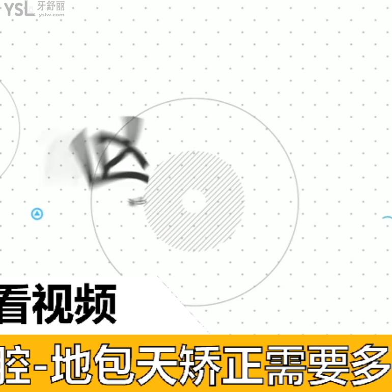 地包天矯正需要多長時間？