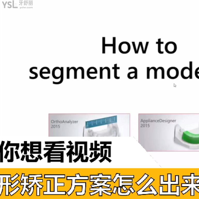 隱形矯正方案怎么出來的？