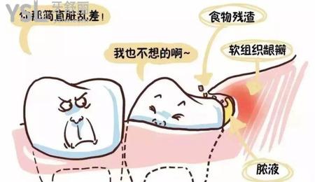 拔智齒后冷敷多長時間？