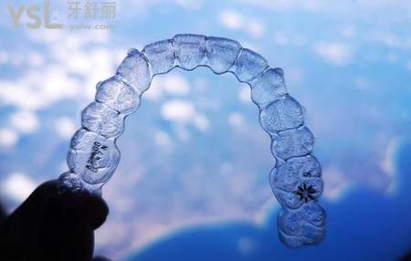 30歲牙齒矯正需要多久？