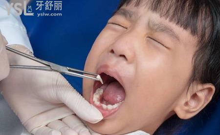 半夜突然牙痛是怎么回事？